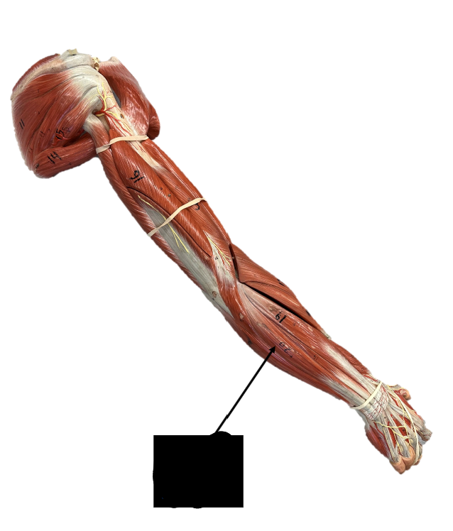 <p>Origin: lateral epicondyle of humerus</p><p>Function: ulnar deviation</p>