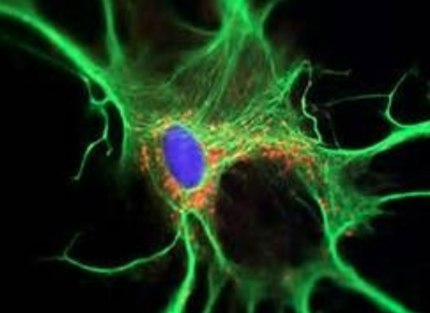 <p>which glial cell?</p><p><mark data-color="yellow" style="background-color: yellow; color: inherit">most abundant</mark> glial cells</p><p><mark data-color="yellow" style="background-color: yellow; color: inherit">CNS</mark></p><p><mark data-color="yellow" style="background-color: yellow; color: inherit">form a hardened scar tissue to fill spaces when neruons are damaged (sclerosis)</mark></p><p>regulate the chemical composition of tissue fluid</p><p>secrete proteins called nerve growth factors that promote neruon growth &amp; synapse function</p><p><mark data-color="yellow" style="background-color: yellow; color: inherit">communicating electrically</mark> with neurons</p><p>form a supportive framework for nervous tissue</p><p>form tight seal called the blood-brain barrier</p><p>convert glucose to lactate &amp; supply neurons for nourishment</p>