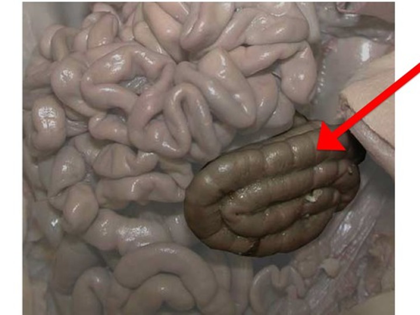 <p>Absorbs water and forms feces.</p><p>The last section of the digestive system, where water is absorbed from food and the remaining material is eliminated from the body.</p>