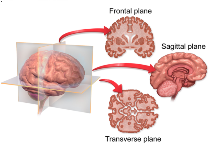 <ul><li><p>A vertical plate which splits the brain into front and back sections. </p></li></ul><p></p>
