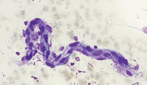 term image
