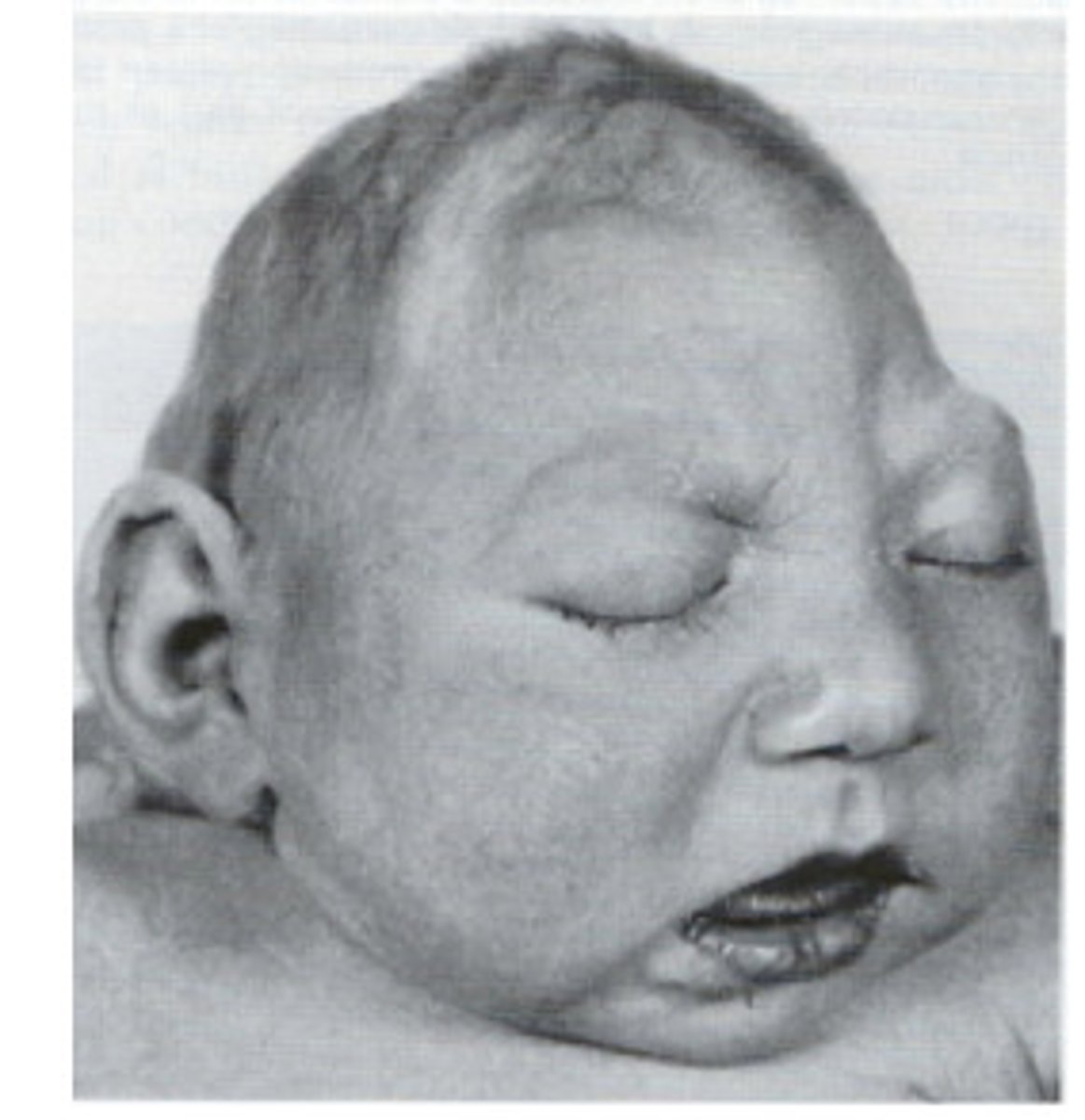 <p>Define Microencephaly</p>