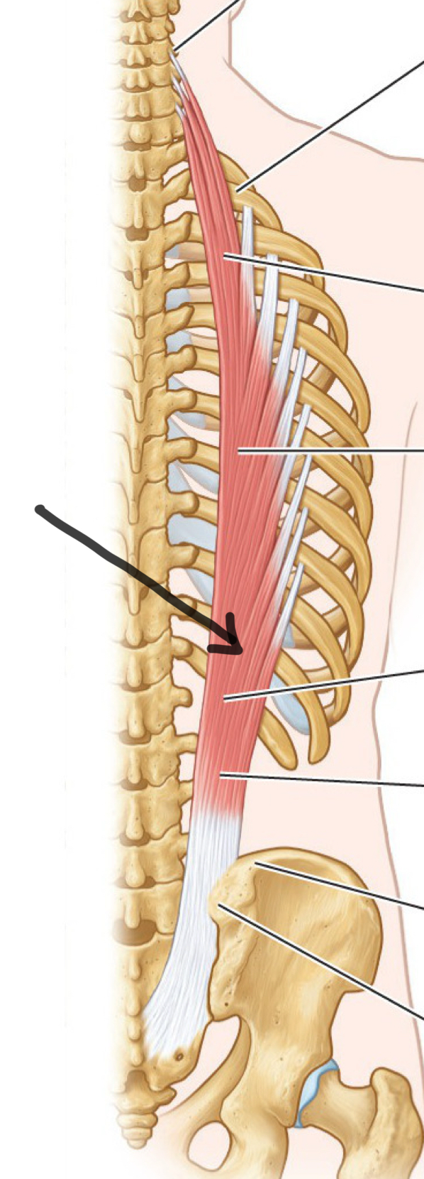 <p>What mm?</p><p>O, I, A bilateral and unilateral</p>