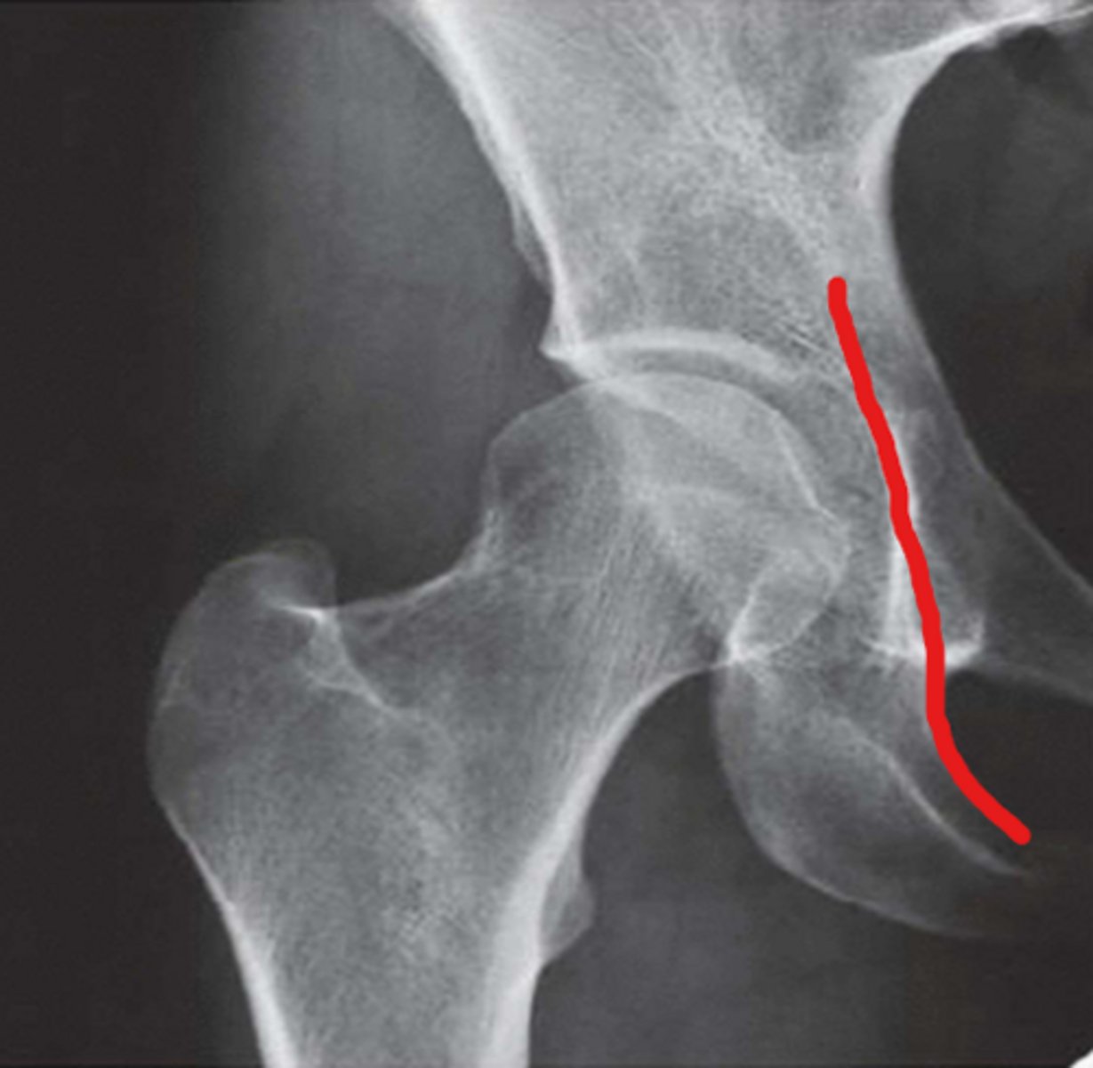 <p>What line is this?</p>