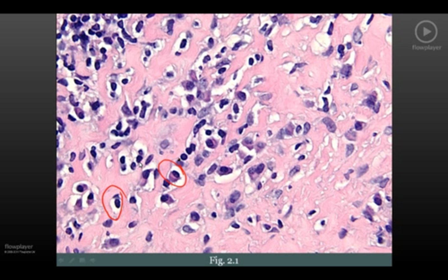 <p>what can you tell by presence of cells</p>