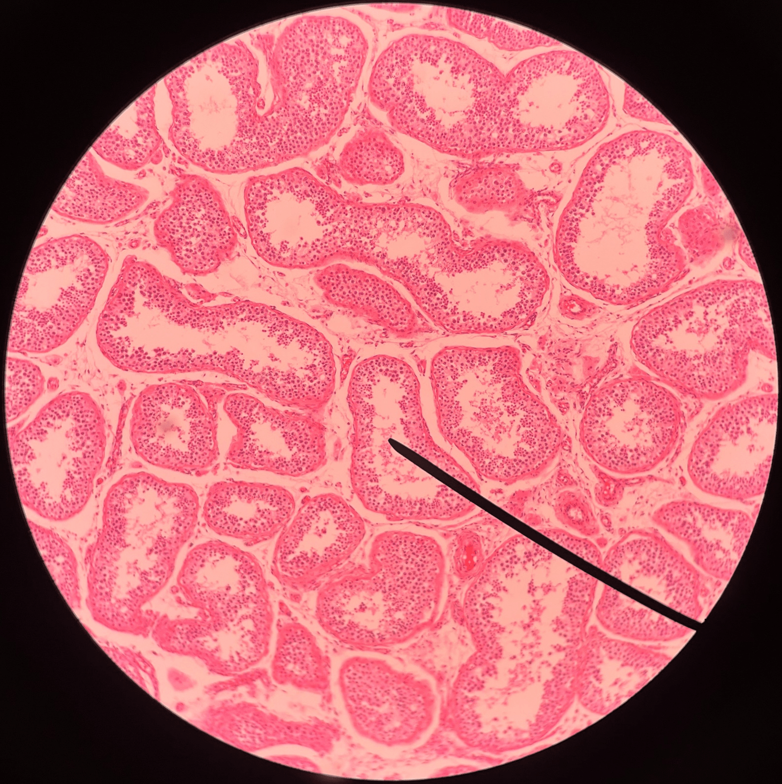 • Slide histology of the testis.

• Located in the lumen of the seminiferous tubules.

• The finished products of spermatogenesis.

• Also known as sperm cells.
