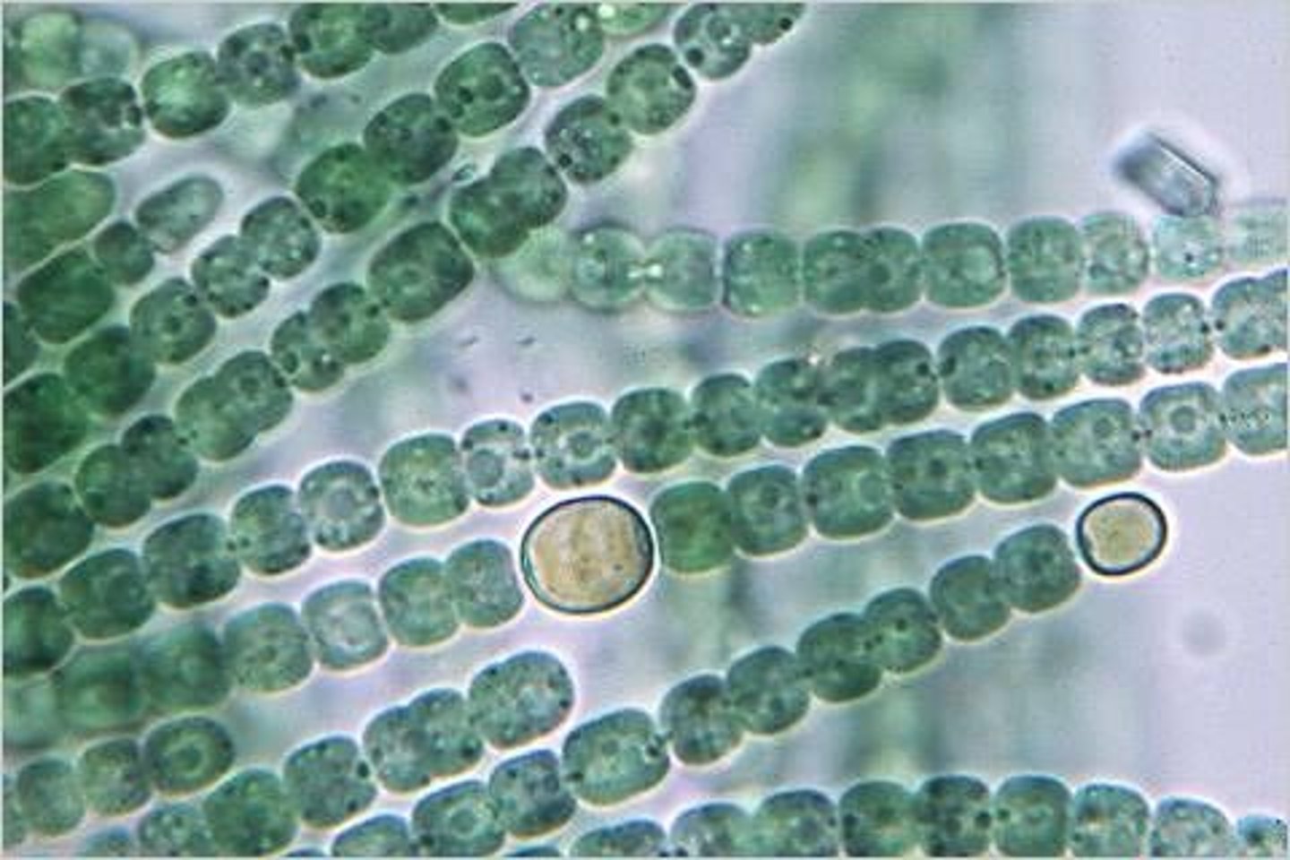 <p>Type of photosynthetic prokaryotes, shown by the way it's arranged like beads on a string (forming filaments)</p>