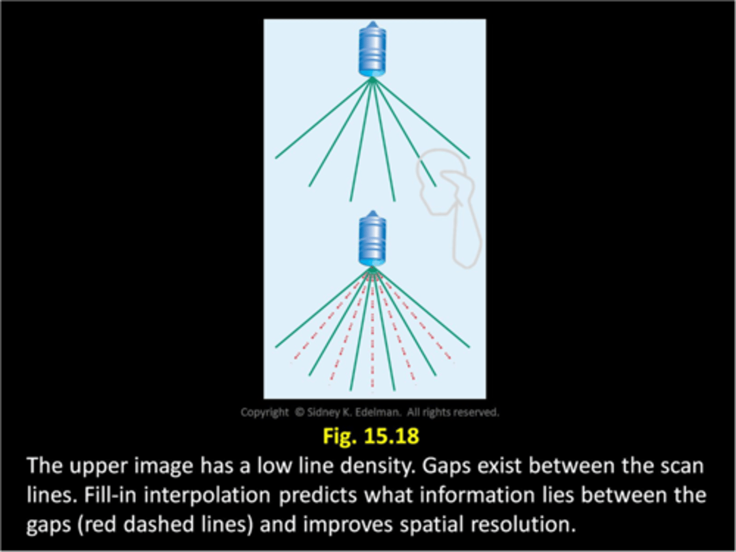 <p>new simulated data points to fill in gaps between scan lines</p>