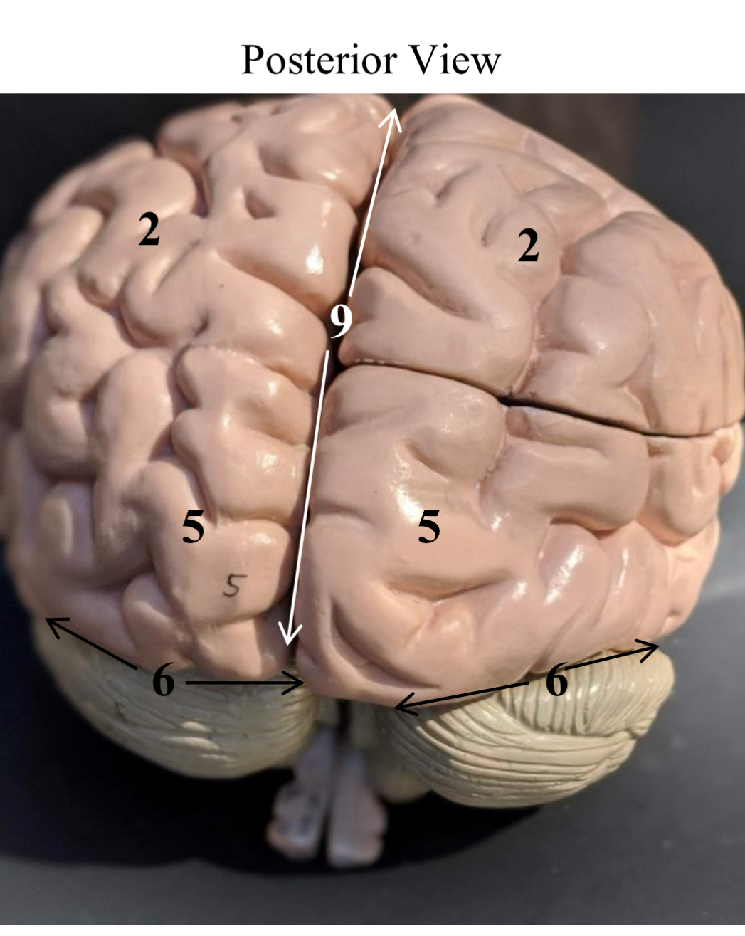 <p>What is 9 pointing at</p>