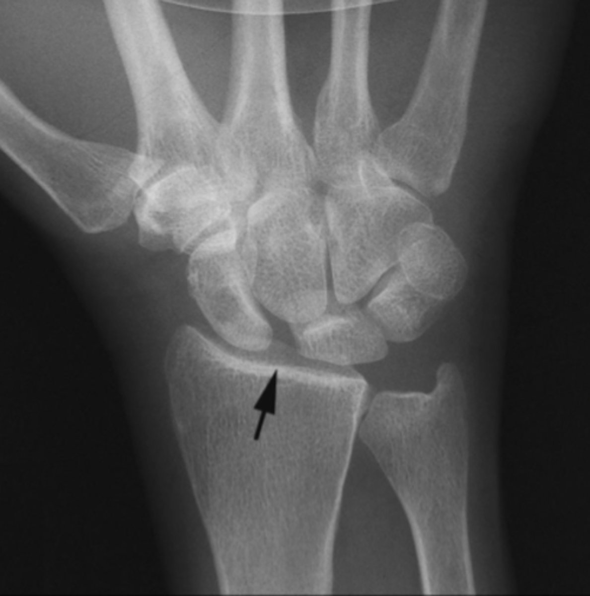 <p>What is the issue?</p>