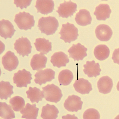 <p>What is the shape of this erythrocyte?</p>