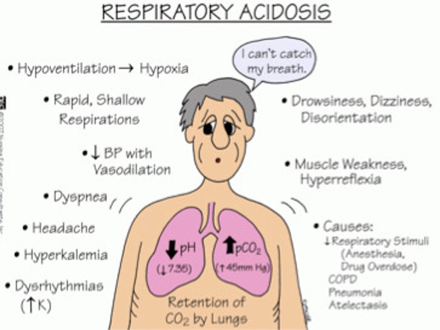 <p>A drop in blood pH due to hypoventilation (too little breathing) and a resulting accumulation of Co2.</p>