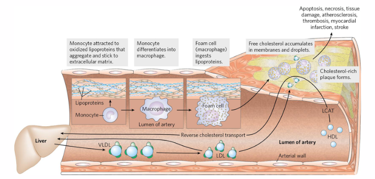 <p>Atherosclerosis: High [LDL] in bloodstream</p>