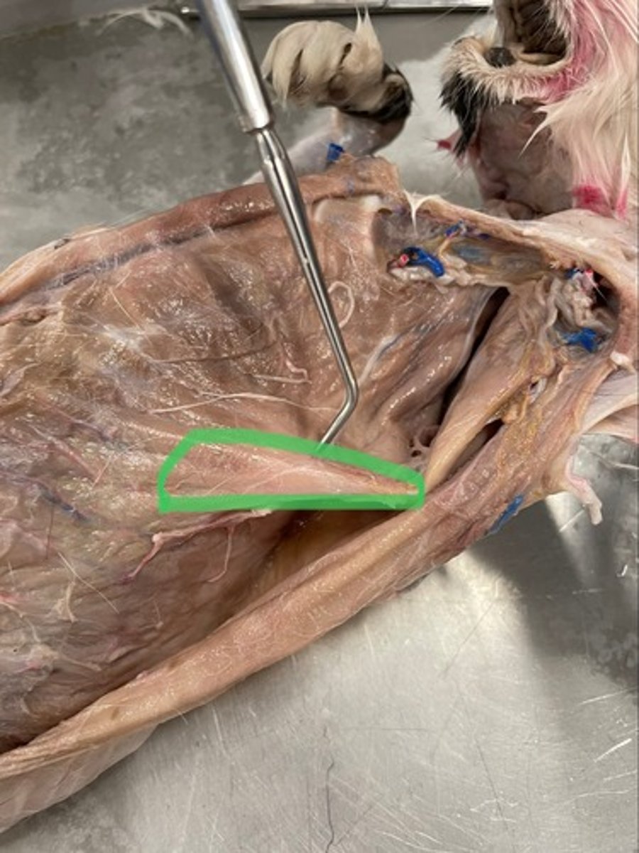<p>O: scapula</p><p>I: lesser tubercle of humerus</p><p>A: extend shoulder; adduct shoulder</p>