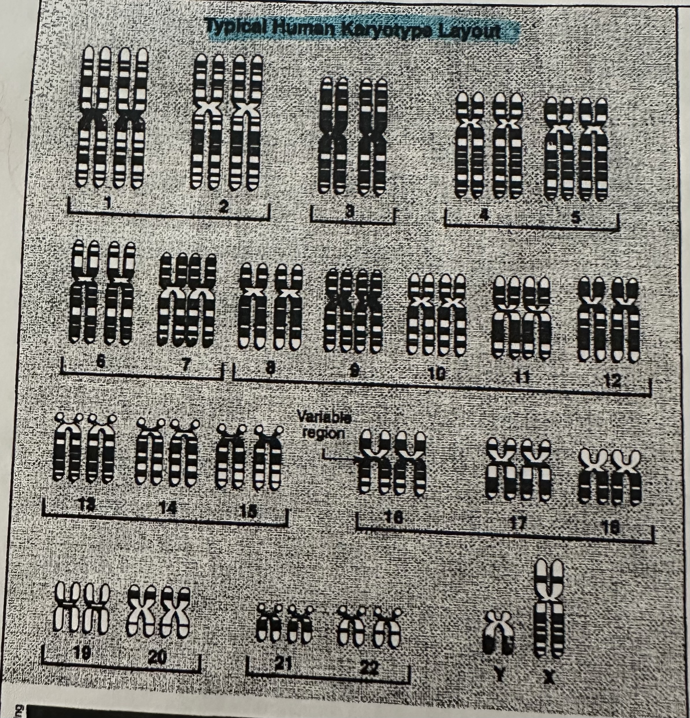 <p>Prepared from nuclei of white blood cells that are “frozen” at metaphase stage of mitosis. A photograph of the chromosomes is cut and rearranged on a grid in homologous pairs.</p>