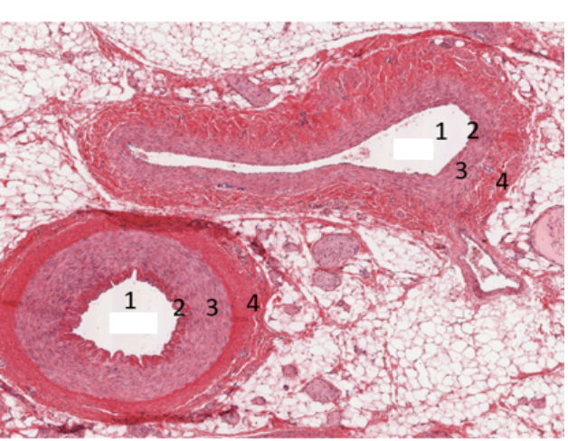 <p>which one is artery, which one is vein</p>