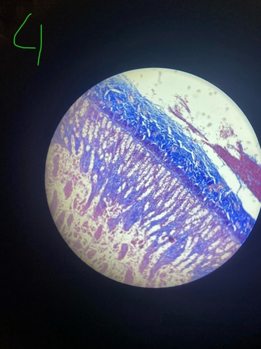 <p>What stain is this?</p>