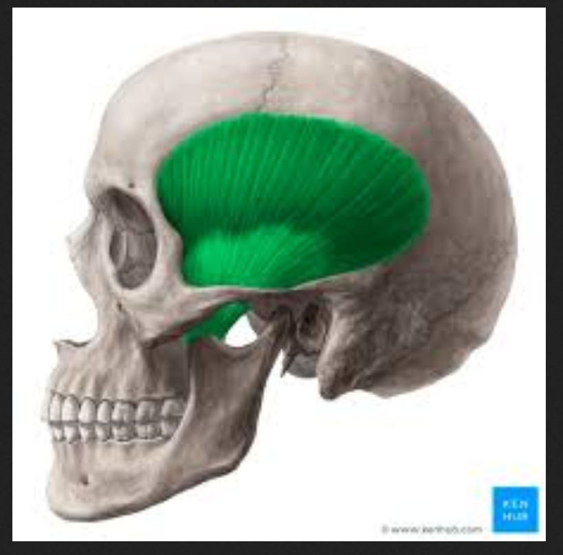 <p>Muscle of the face, head, and neck:</p><p>Temporalis</p>