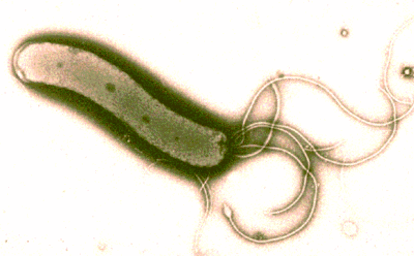 <p>Caused by the gram-negative helicobacter pylori, transmitted person-to-person by saliva or by fecal contamination of food or water, good hygiene is aa way to prevent it, and antibiotics are used as treatment.</p>