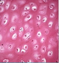 <ul><li><p><span style="background-color: transparent; font-family: "Book Antiqua", serif;"><span>Most common</span></span></p></li><li><p><span style="background-color: transparent; font-family: "Book Antiqua", serif;"><span>Predominant model for the formation of our skeleton</span></span></p></li><li><p><span style="background-color: transparent; font-family: "Book Antiqua", serif;"><span>Cell known as chondrocyte and sits in a lacunae</span></span></p></li><li><p><span style="background-color: transparent; font-family: "Book Antiqua", serif;"><span>No fibers in the matrix</span></span></p></li><li><p><span style="background-color: transparent; font-family: "Book Antiqua", serif;"><span>Found in nose and the trachea</span></span></p></li></ul><p></p>