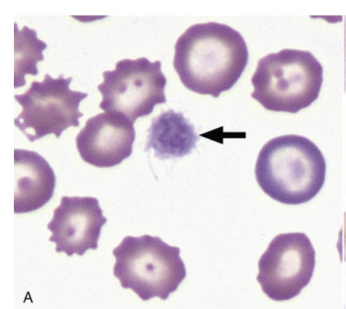 <p>what type of RBC abnormality is this</p>