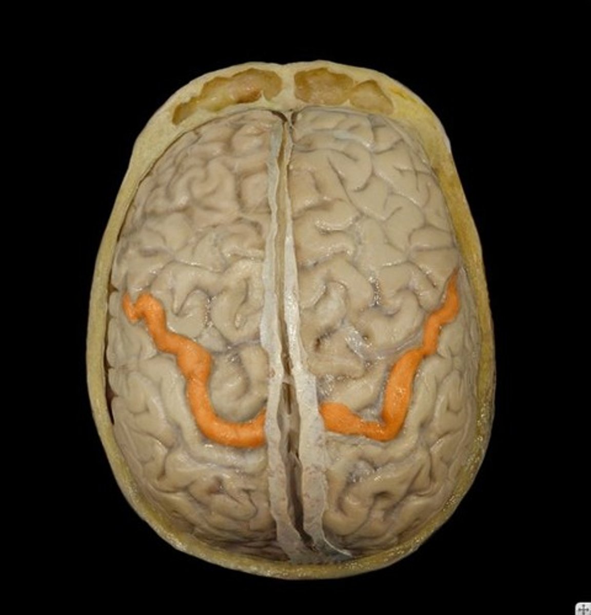 knowt flashcard image