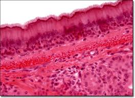 <p>Appears stratified but all cells touch basement membrane; cilia move mucus.</p>