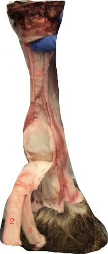 palmar view- what is at 3?