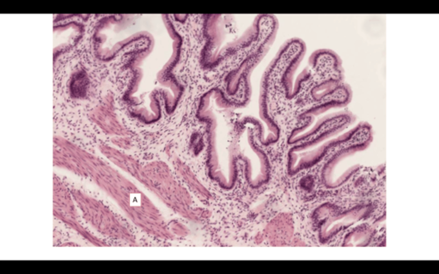 <p>Usually smooth muscle layers (Skeletal in part of the esophagus), commonly arranged in an inner circular and an outer longitudinal layer (GI Tract)</p>