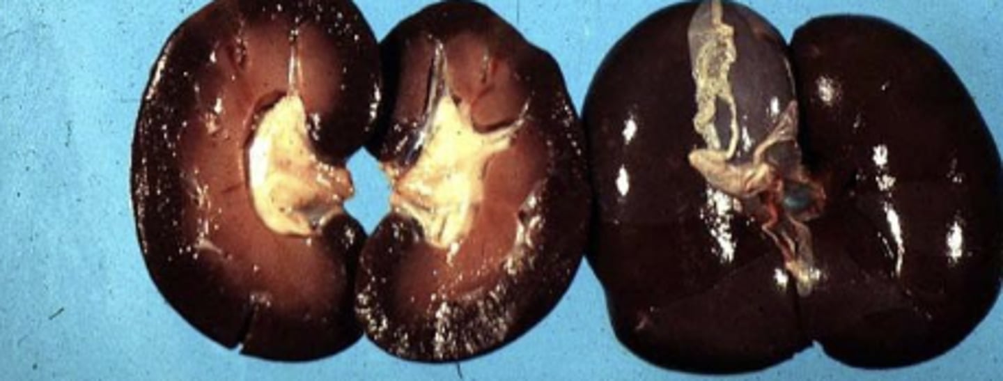 <p>What has caused this kidney to be gunmetal black, dark red color?</p>