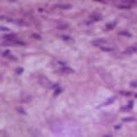 <p>What tissue type does this image depict?</p>