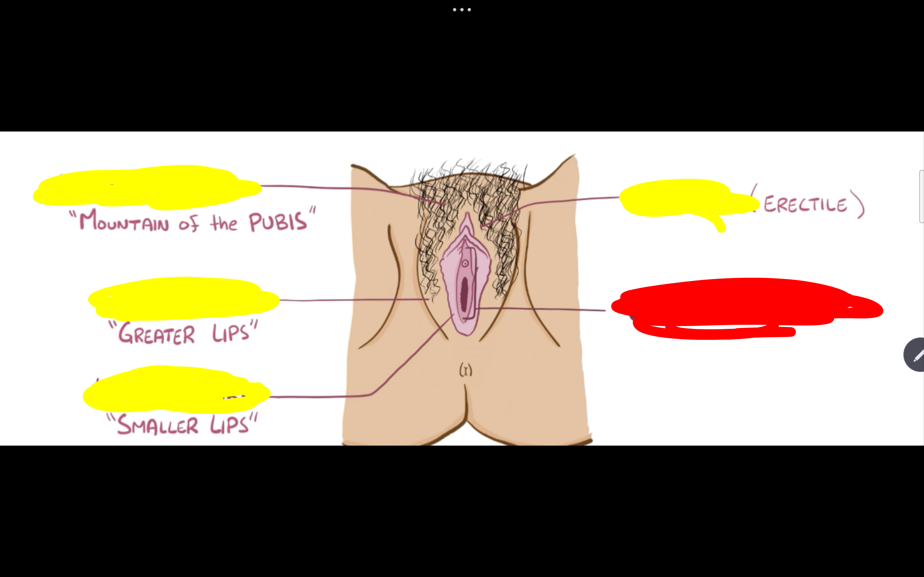 <p>Name the structure in red</p>