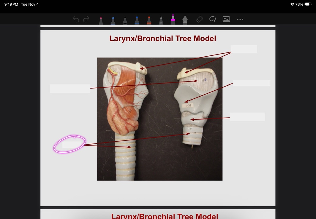 <p>What is this?</p>