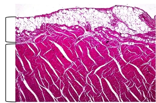 <p>which heart layers?</p>