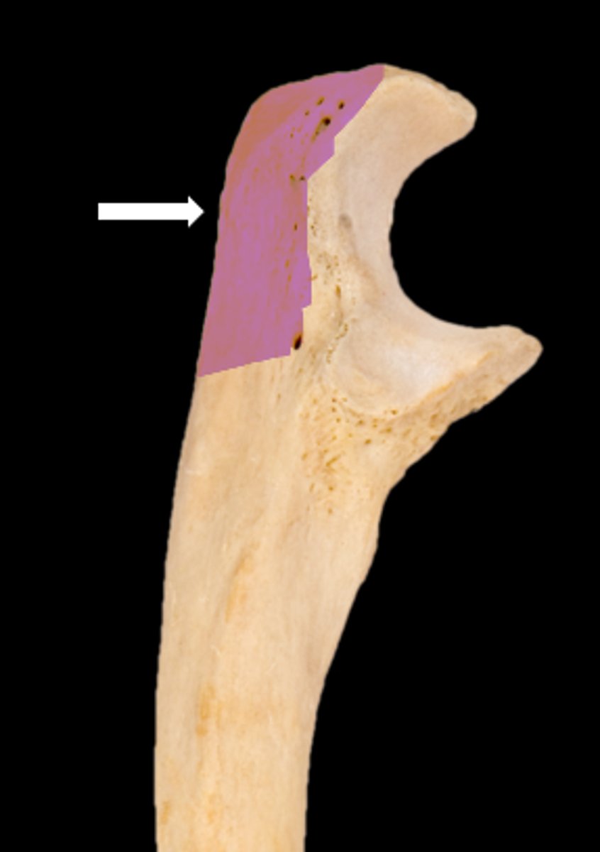 <p>name the part</p>