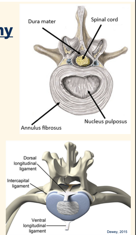 <p><u>I</u><strong><u>ntervertebral disc : present between all vertebrae except C1-2. (C1-2 synovial joint instead)</u></strong></p><p>2 components: </p><ul><li><p><strong>Nucleus pulposus</strong>: inner component, gelatinous in young normal animals </p></li><li><p><strong>Annulus fibrosus:</strong> outer layer, fibrous, ventral portion thicker than dorsal</p></li></ul><p><strong><u>Intercapital ligament – between rib head on either side of vertebrae, T2 to T10</u></strong></p><ul><li><p>cover annulus fibrosus dorsally to reinforce, IVDD unusual in these locations</p></li></ul><p></p>