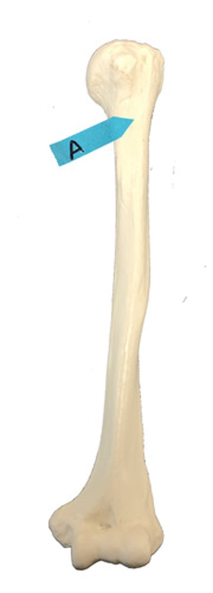 <p>Identify this bone marking.</p>
