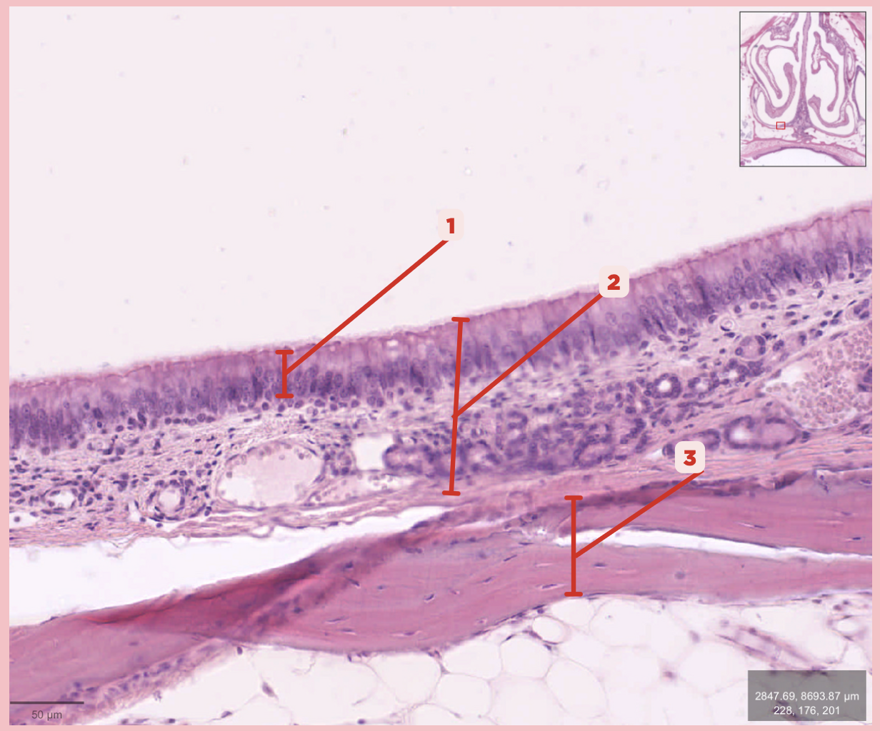 <p>Identify the structure labeled as 3.</p>