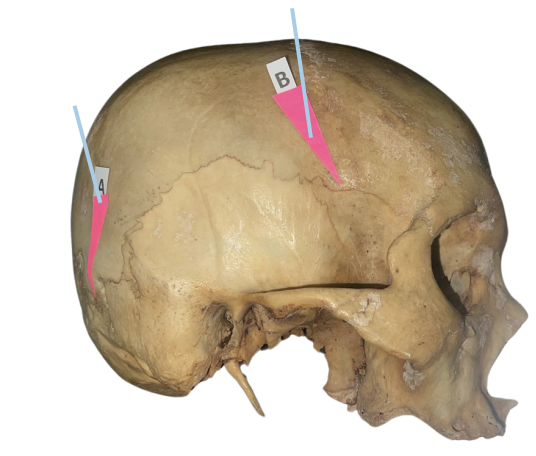 <p>Identify the suture labeled as A.</p>