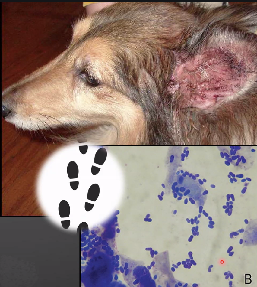 <p>What yeast infection is shown?</p>