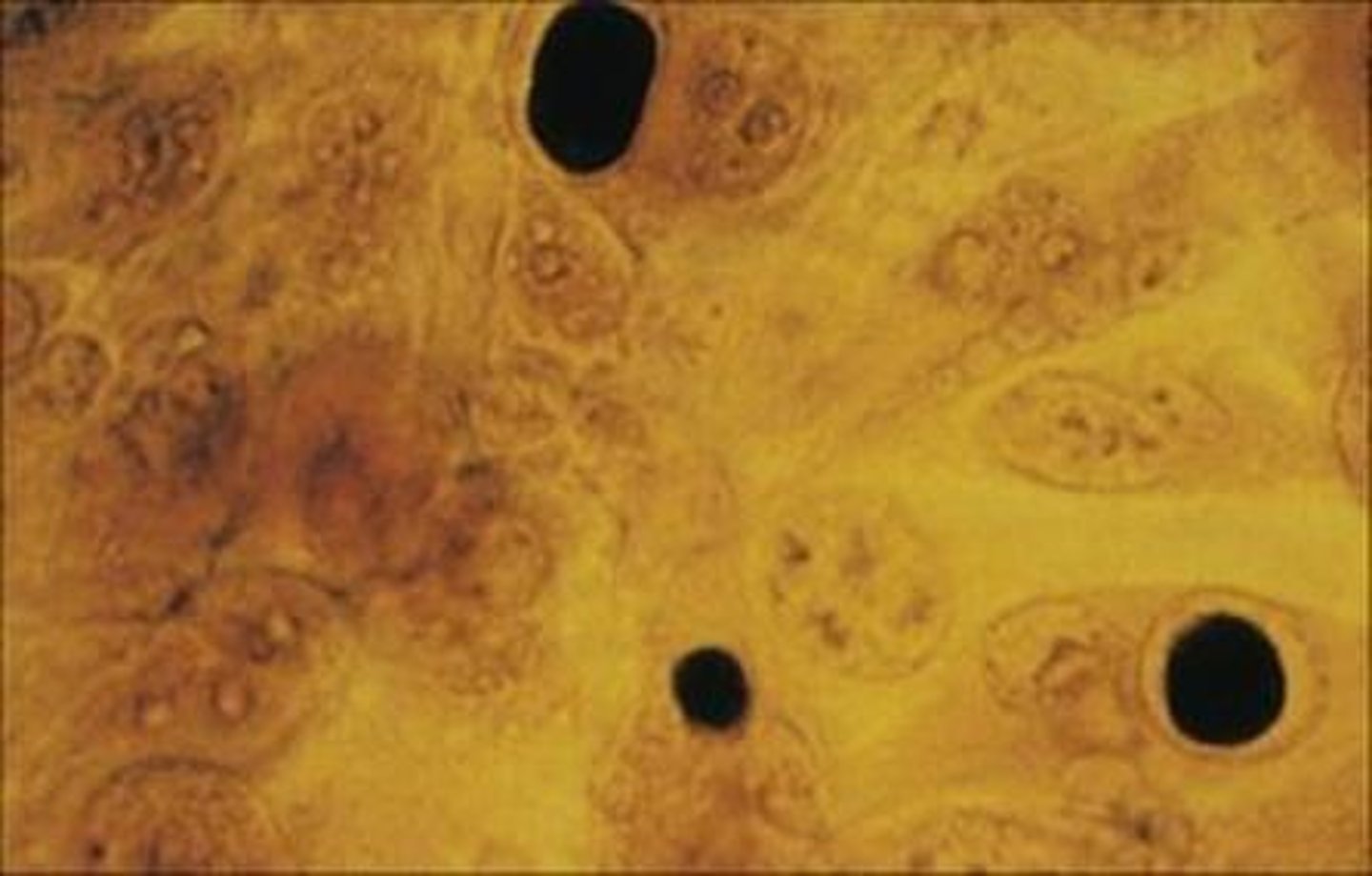 <p>Inoculate cycloheximide treated McCoy cells.</p>