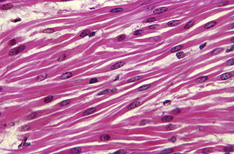 <p>Found in viscera (internal organs inside your chest or abdomen), blood vessels, skin</p><p>Not striated because actin and myosin are arranged randomly, no repeating pattern</p><p>Under involuntary control</p>