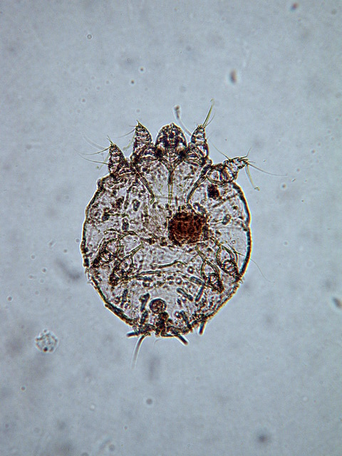 <p>what kind of mite</p>