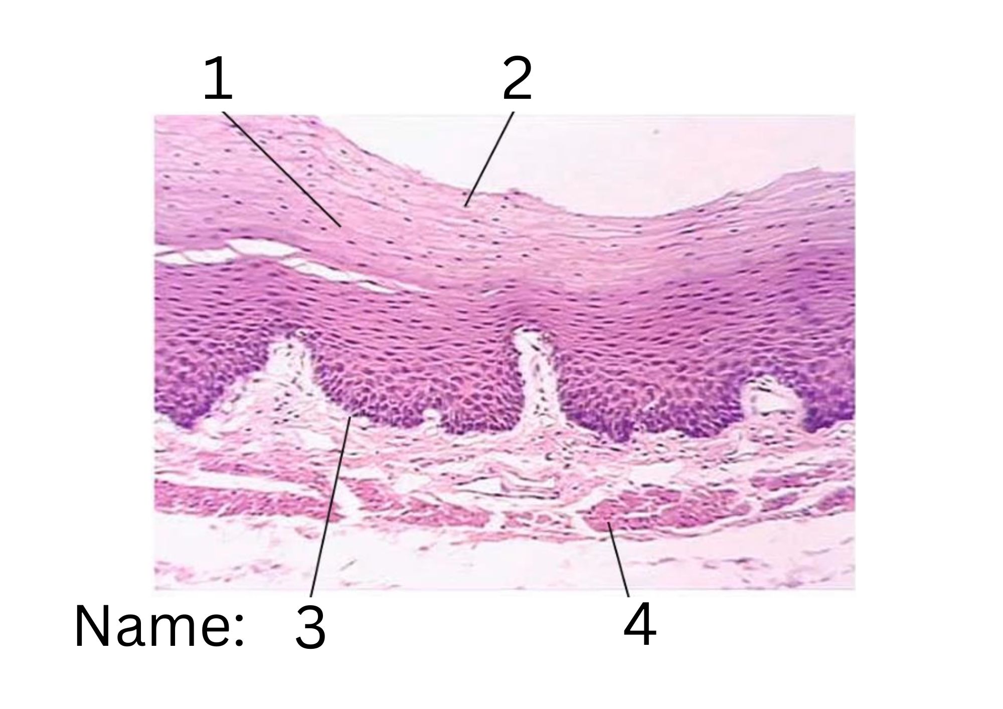 term image