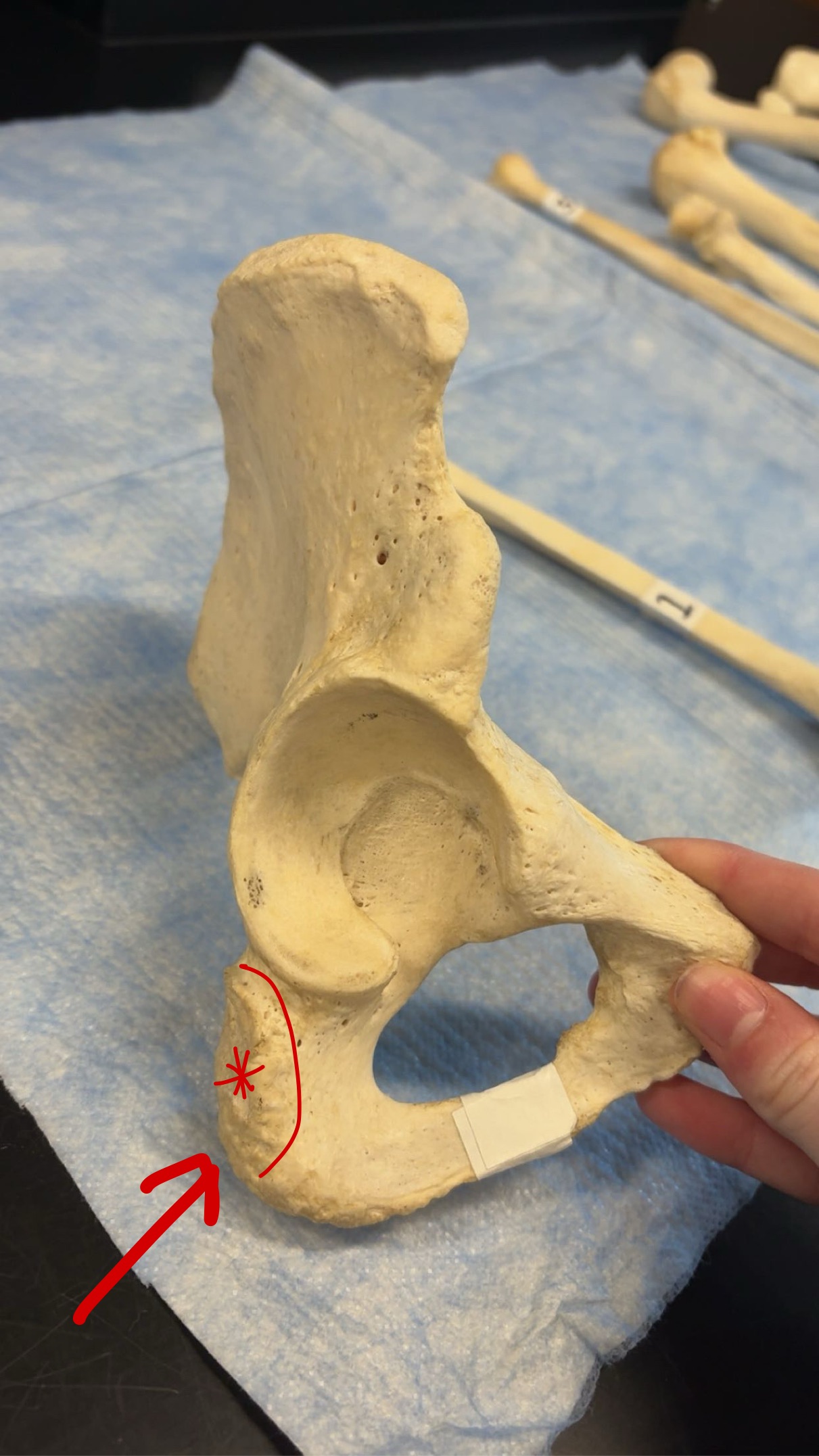 <p>Name this structure</p>