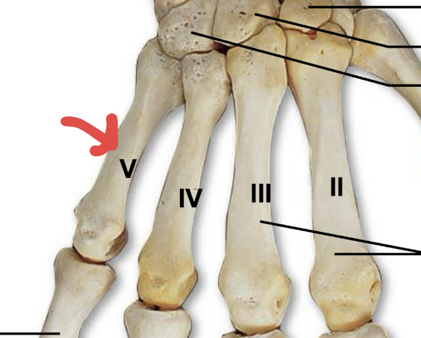 <p>what is this part of the metacarpals?</p>