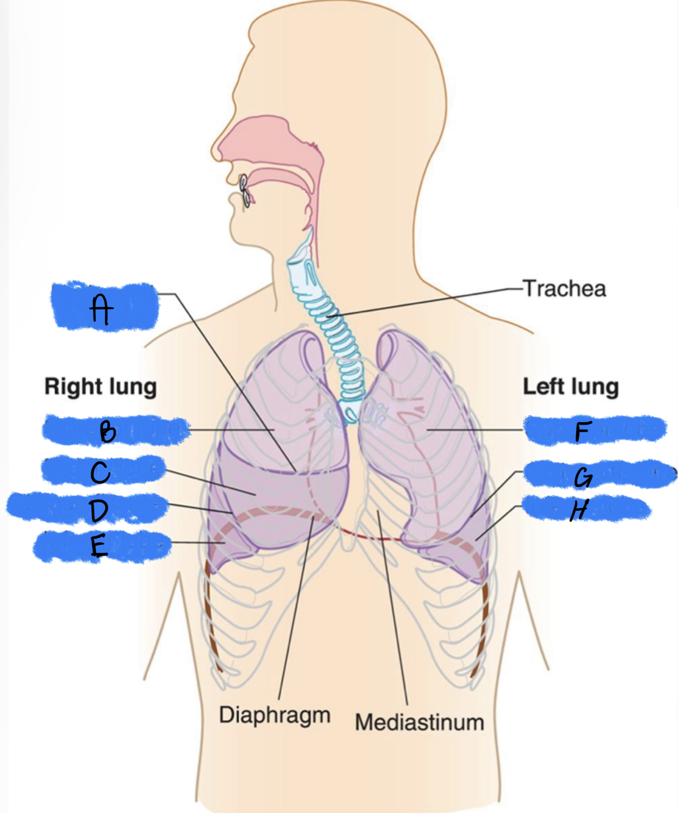 Which letters are the Superior & inferior lobes of the Left lung? 