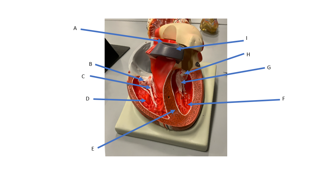 <p>what is A&nbsp;</p>