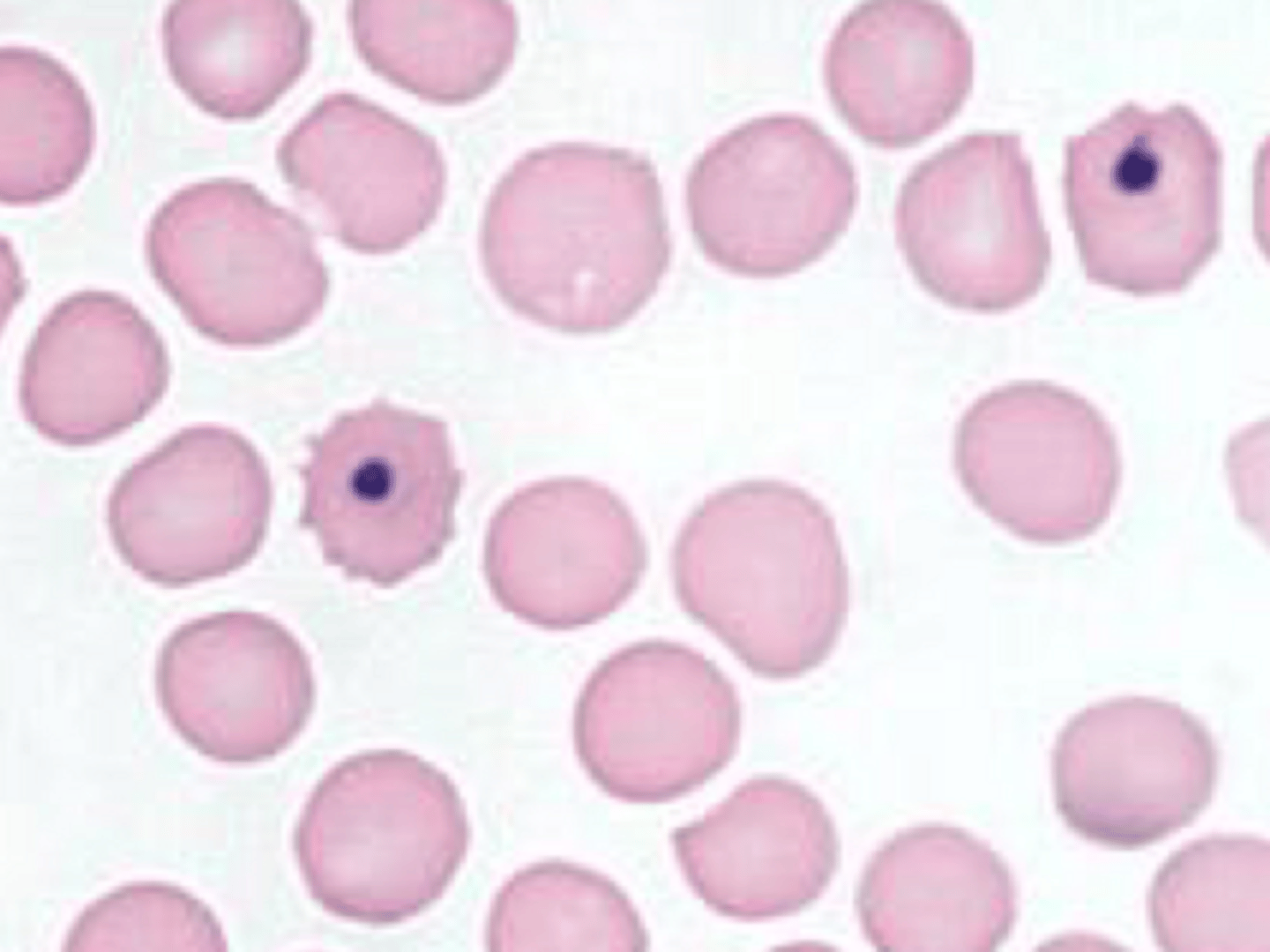 <p>What is a Howell jolly body?</p>