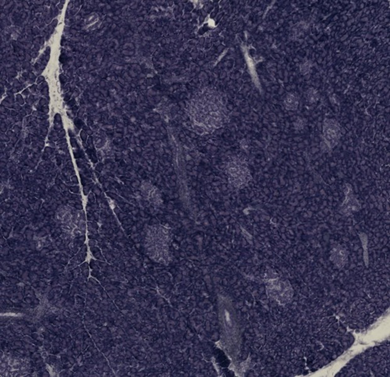 <p>Name the organ</p>